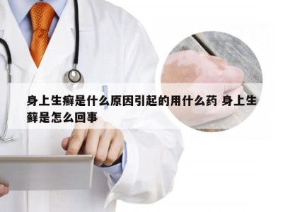 身上生癣是什么原因引起的用什么药 身上生藓是怎么回事