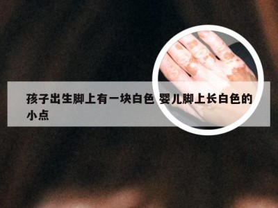 孩子出生脚上有一块白色 婴儿脚上长白色的小点