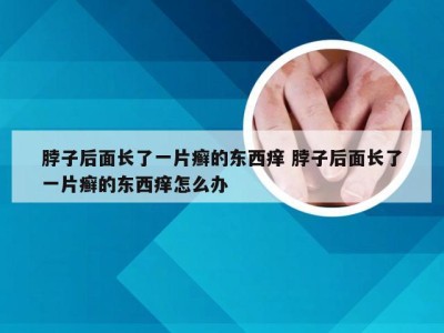 脖子后面长了一片癣的东西痒 脖子后面长了一片癣的东西痒怎么办