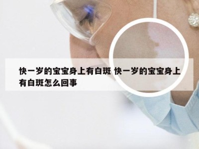 快一岁的宝宝身上有白斑 快一岁的宝宝身上有白斑怎么回事