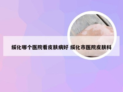 绥化哪个医院看皮肤病好 绥化市医院皮肤科