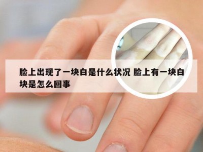 脸上出现了一块白是什么状况 脸上有一块白块是怎么回事