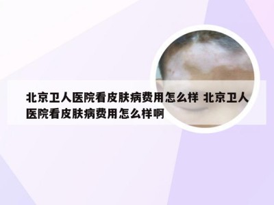 北京卫人医院看皮肤病费用怎么样 北京卫人医院看皮肤病费用怎么样啊