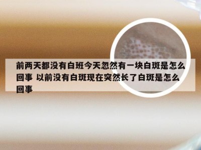 前两天都没有白班今天忽然有一块白斑是怎么回事 以前没有白斑现在突然长了白斑是怎么回事