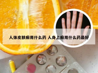 人体皮肤癣用什么药 人身上癣用什么药最好