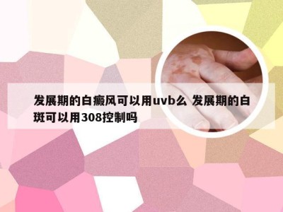 发展期的白癜风可以用uvb么 发展期的白斑可以用308控制吗