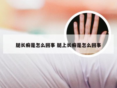 腿长癣是怎么回事 腿上长癣是怎么回事