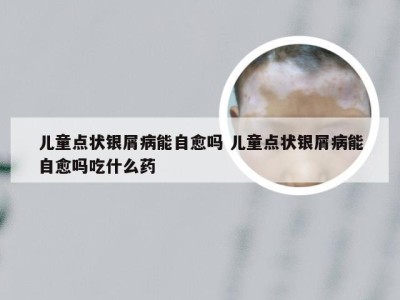 儿童点状银屑病能自愈吗 儿童点状银屑病能自愈吗吃什么药