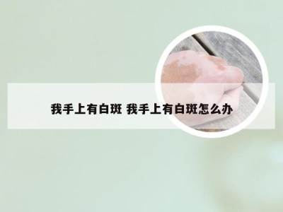 我手上有白斑 我手上有白斑怎么办