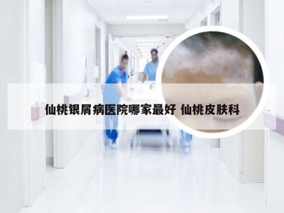 仙桃银屑病医院哪家最好 仙桃皮肤科