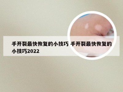 手开裂最快恢复的小技巧 手开裂最快恢复的小技巧2022