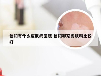 信阳有什么皮肤病医院 信阳哪家皮肤科比较好