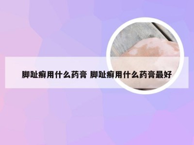 脚趾癣用什么药膏 脚趾癣用什么药膏最好