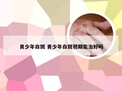 青少年白斑 青少年白斑初期能治好吗