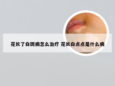 花长了白斑病怎么治疗 花长白点点是什么病