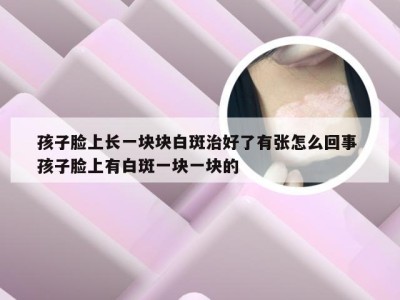 孩子脸上长一块块白斑治好了有张怎么回事 孩子脸上有白斑一块一块的