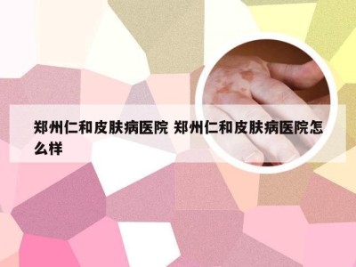 郑州仁和皮肤病医院 郑州仁和皮肤病医院怎么样