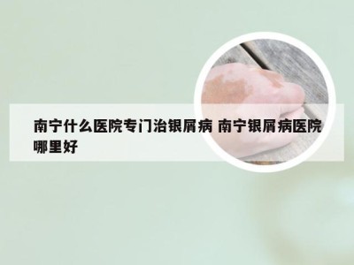 南宁什么医院专门治银屑病 南宁银屑病医院哪里好