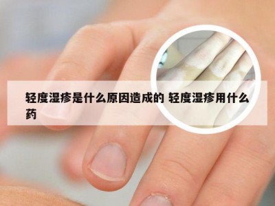 轻度湿疹是什么原因造成的 轻度湿疹用什么药