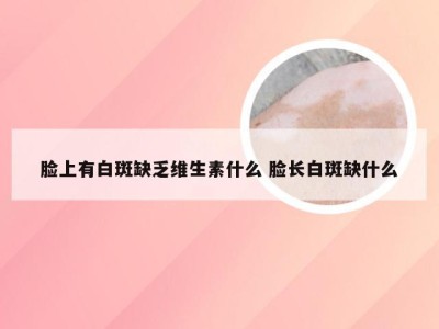 脸上有白斑缺乏维生素什么 脸长白斑缺什么