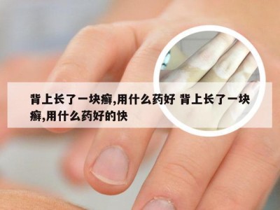 背上长了一块癣,用什么药好 背上长了一块癣,用什么药好的快