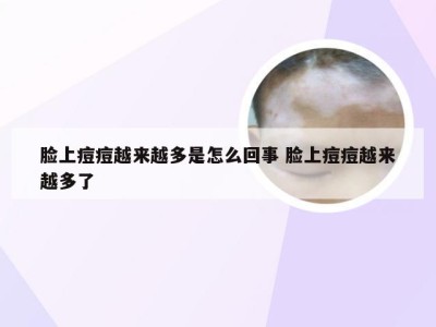 脸上痘痘越来越多是怎么回事 脸上痘痘越来越多了