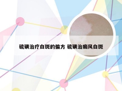 硫磺治疗白斑的偏方 硫磺治癜风白斑