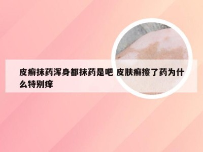 皮癣抹药浑身都抹药是吧 皮肤癣擦了药为什么特别痒