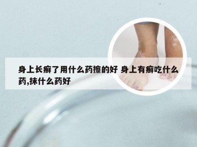 身上长癣了用什么药擦的好 身上有癣吃什么药,抹什么药好