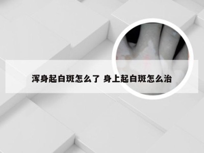 浑身起白斑怎么了 身上起白斑怎么治