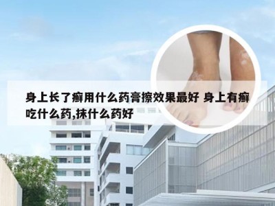 身上长了癣用什么药膏擦效果最好 身上有癣吃什么药,抹什么药好