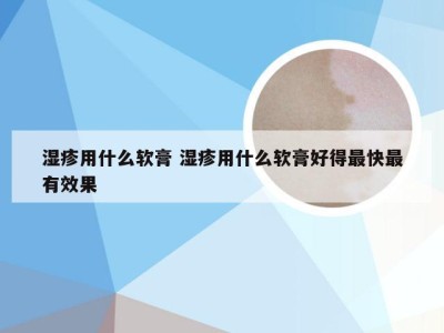 湿疹用什么软膏 湿疹用什么软膏好得最快最有效果