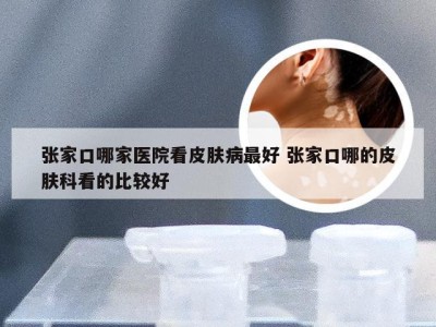 张家口哪家医院看皮肤病最好 张家口哪的皮肤科看的比较好