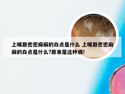 上嘴唇密密麻麻的白点是什么 上嘴唇密密麻麻的白点是什么?原来是这种病!