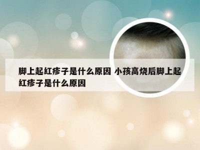 脚上起红疹子是什么原因 小孩高烧后脚上起红疹子是什么原因