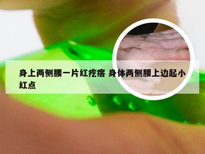 身上两侧腰一片红疙瘩 身体两侧腰上边起小红点