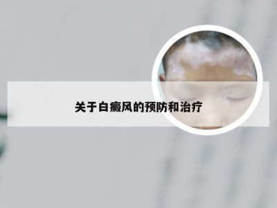 关于白癜风的预防和治疗