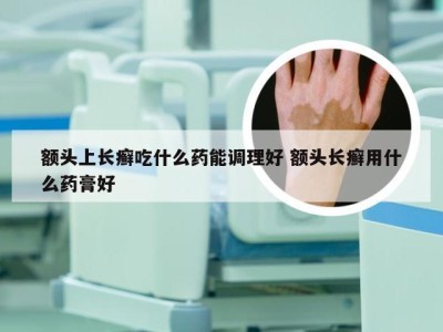 额头上长癣吃什么药能调理好 额头长癣用什么药膏好