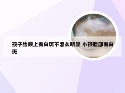 孩子脸颊上有白斑不怎么明显 小孩脸部有白斑