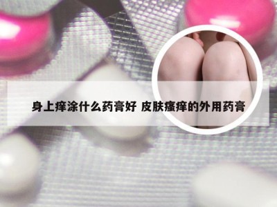 身上痒涂什么药膏好 皮肤瘙痒的外用药膏