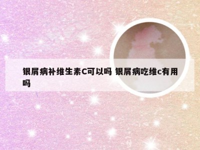 银屑病补维生素C可以吗 银屑病吃维c有用吗