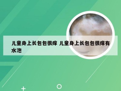 儿童身上长包包很痒 儿童身上长包包很痒有水泡