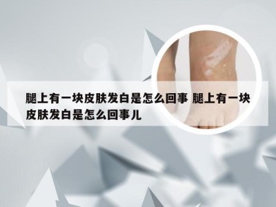 腿上有一块皮肤发白是怎么回事 腿上有一块皮肤发白是怎么回事儿