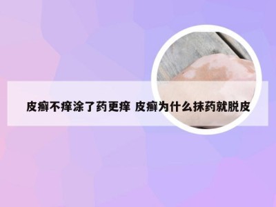 皮癣不痒涂了药更痒 皮癣为什么抹药就脱皮