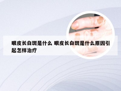 眼皮长白斑是什么 眼皮长白斑是什么原因引起怎样治疗