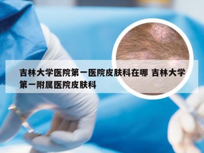 吉林大学医院第一医院皮肤科在哪 吉林大学第一附属医院皮肤科