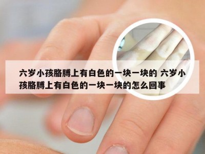 六岁小孩胳膊上有白色的一块一块的 六岁小孩胳膊上有白色的一块一块的怎么回事