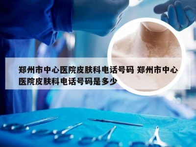 郑州市中心医院皮肤科电话号码 郑州市中心医院皮肤科电话号码是多少