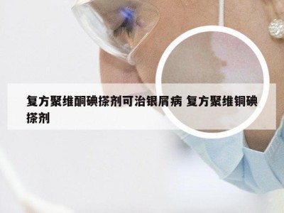 复方聚维酮碘搽剂可治银屑病 复方聚维铜碘搽剂