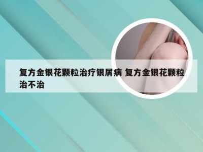 复方金银花颗粒治疗银屑病 复方金银花颗粒治不治